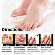 Nail Fungals Treatment Strength Nail Repair Thick Cracked Discolored Nails Toenail & Fingernail Care Solution Restore Healthy Nails 30ml White Golden - 預設 - 查看 3