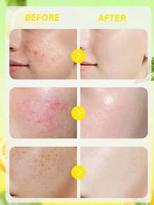 Kem dưỡng da Garnier Bright Complete Vitamin C & Chanh Revitalizing Cream, Làm mờ vết thâm, Chống nắng, Loại bỏ vết thâm, Làm sáng, Chống lão hóa, Chống oxy hóa, Chống tia UV, Kết cấu tươi mới, Dưỡng ẩm, Không nhờn, Dễ thẩm thấu, Phục hồi, Làm trắng, Dành cho mọi loại da, Lý tưởng để sử dụng hàng ngày - 23g - Xem 2