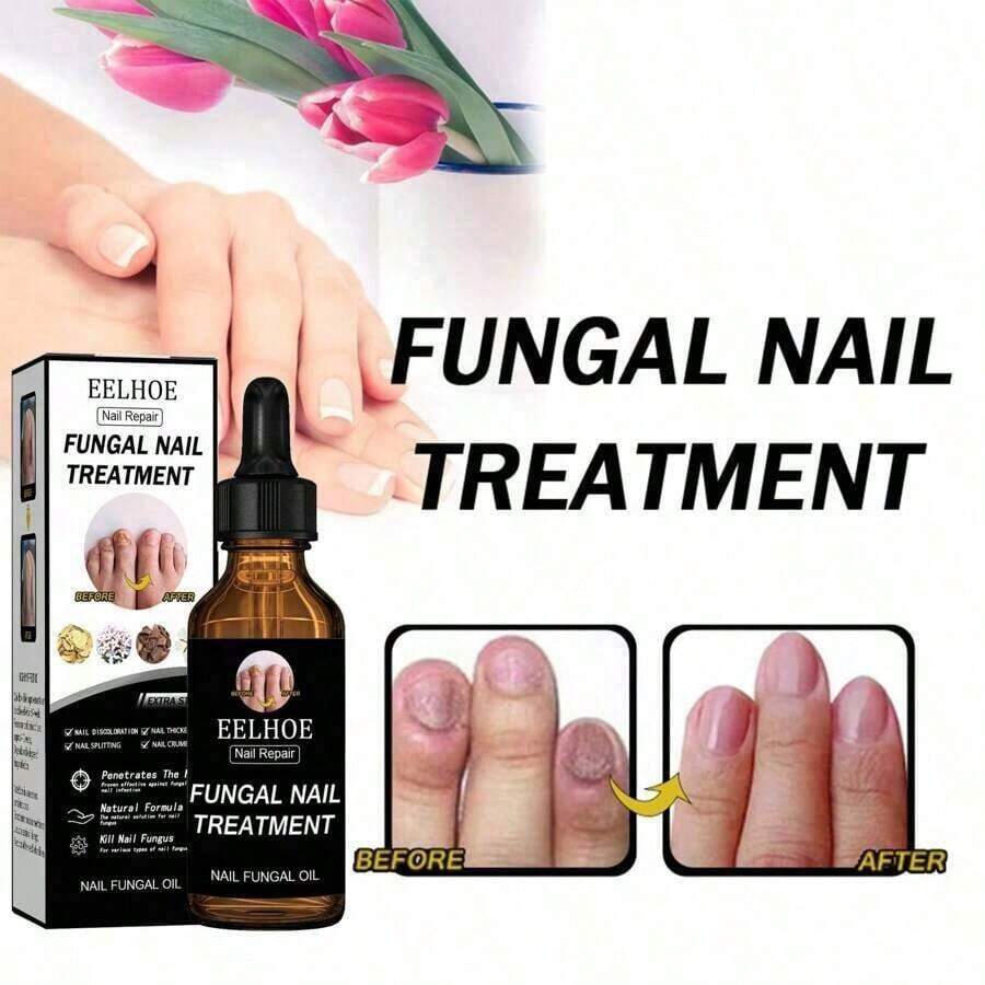 Feet Care Essence For Nail Fungal Treatment Feet Care Repair Moisturizing Nail Anti Infection Care Liquid Obat Kuku Yang Rusak - Mặc định - Xem 1