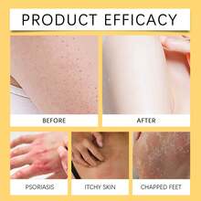 蜜蜂皮肤修复霜，蜜蜂护理霜，紧致肌肤护理，减少皱纹和保湿，适合所有肤质