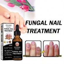 Nail Fungals Treatment Strength Nail Repair Thick Cracked Discolored Nails Toenail & Fingernail Care Solution Restore Healthy Nails 30ml White Golden - 預設 - 查看 1