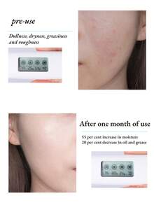 Juegos para el cuidado de la piel de la cara de arroz, Conjuntos para el cuidado de la piel,juego de 7 productos para el cuidado de la piel, Conjuntos para el cuidado de la piel,juego de regalo hidratante para el cuidado de la piel para mujeres y niñas, kit de cuidado facial que incluye máscara de arroz, limpiador, crema para ojos, suero facial, crema facial, tónico, Tratamientos y Serums Faciales - Blanco - Ver 5