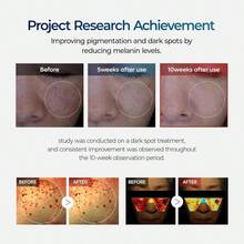 Tranexamic Acid Cream - 50ml, A Freckle Cream That Reduces Blemishes, Combats Hyperpigmentation, Moisturizes, Improves Dullness, And Brightens Skin. Suitable For All Skin Types. - 藍白色 - 查看 6