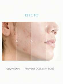 Juegos para el cuidado de la piel de la cara de arroz, Conjuntos para el cuidado de la piel,juego de 7 productos para el cuidado de la piel, Conjuntos para el cuidado de la piel,juego de regalo hidratante para el cuidado de la piel para mujeres y niñas, kit de cuidado facial que incluye máscara de arroz, limpiador, crema para ojos, suero facial, crema facial, tónico, Tratamientos y Serums Faciales - Blanco - Ver 3