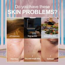 1/5/10/15pcs Korean Collagen Moisturizing Face Mask. Replenish Skin Moisture, Moisturize And Control Oil, Brighten Complexion, Repair Sun Damage, Even Out Skin Tone, Reduce Wrinkles, And Make Skin Radiant. Improve Skin Elasticity, Smooth Skin, And Improve Dullness. - Multicolor - View 5