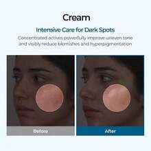 Tranexamic Acid Cream - 50ml, A Freckle Cream That Reduces Blemishes, Combats Hyperpigmentation, Moisturizes, Improves Dullness, And Brightens Skin. Suitable For All Skin Types. - 藍白色 - 查看 2