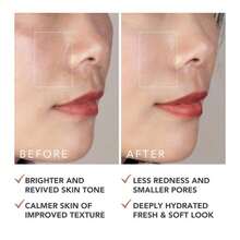 FOREO SUPERCHARGED Barrier Restoring Essence Mist, 37 Fl Oz - Collagen Boosting Spray Moisturiser - Collagen Peptides, Niacinamide, Centella Asiatica, Panthenol - Face Mist For All Skin Types - Trắng - Xem 5