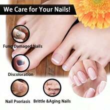 Feet Care Essence For Nail Fungal Treatment Feet Care Repair Moisturizing Nail Anti Infection Care Liquid Obat Kuku Yang Rusak - Mặc định - Xem 5