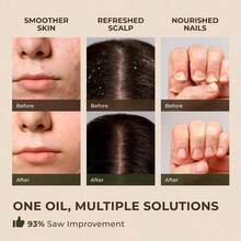 Gya Labs Australian Tea Tree Essential Oil For Skin 0.34 Fl Oz 100% Pure Natural Melaleuca Tea Tree Oil For Hair Face And Toenail Piercings Scalp And Candle Making Scent