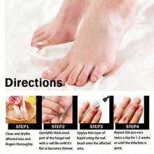 Feet Care Essence For Nail Fungal Treatment Feet Care Repair Moisturizing Nail Anti Infection Care Liquid Obat Kuku Yang Rusak - Mặc định - Xem 3