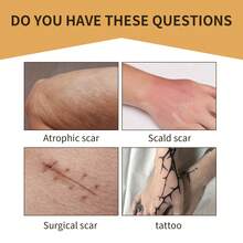 Temporary Tattoo Cover-Up Patches Waterproof Sweatproof Full Covering Scar Tattoo Concealing Body Flaws Ultra-Thin Soft Breathable Invisible Skin Tone Tapes Suitable For Tattoos/Scars/Birthmarks - 米色 - 查看 4
