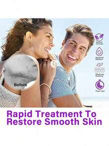 Crema de ácido azelaico, 1 suero de ácido azelaico al 12% con ácido hialurónico y niacinamida, gel de ácido azelaico para reducir las imperfecciones y el acné rosácea, humecta y equilibra el sebo. - Morado - Ver 5