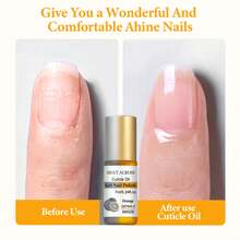 MEET ACROSS Peach Smell 7ml Cuticle Oil Nail Care Nutrition Nails Repair Hand Cuticle Manicure, Revitalizer Oil Prevent Agnail Nail Polish Nourish Skin Treatment Nail Strengthening Care Nails Art
