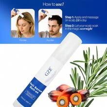 GZE Scalp And Hair Essence Roller, Containing Rosemary And Babassu Oil - Moisturizing Essence, Keeps Scalp Healthy, Hair Smooth And Silky, Say Goodbye To Frizzy Hair