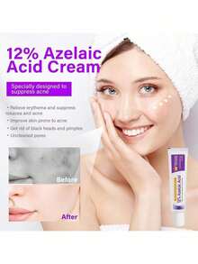 Crema de ácido azelaico, 1 suero de ácido azelaico al 12% con ácido hialurónico y niacinamida, gel de ácido azelaico para reducir las imperfecciones y el acné rosácea, humecta y equilibra el sebo. - Morado - Ver 3