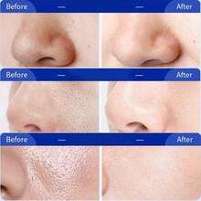 白米去角质水，深层清洁毛孔，改善粗糙肌肤和黑头，清爽保湿，令肌肤光滑 - 米色 - 查看 3