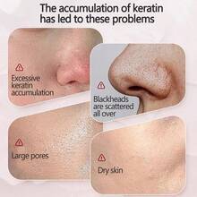 白米去角质水，深层清洁毛孔，改善粗糙肌肤和黑头，清爽保湿，令肌肤光滑 - 米色 - 查看 4