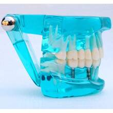WWKTS Removable Dental Model Adult Tooth Demonstration Anatomical Medical Practice Model - Blue - View 5