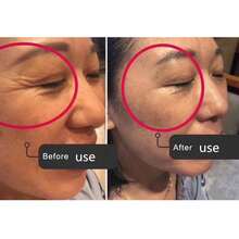 Masajeador facial y ocular dos en uno/masajeador de mascarilla/masajeador de cuerpo completo - Dorado - Ver 4