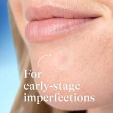 360片/144片肤色透明疤痕遮盖贴，水胶体材质，温和无刺激，无酒精，遮瑕