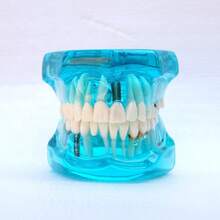 WWKTS Removable Dental Model Adult Tooth Demonstration Anatomical Medical Practice Model - Blue - View 4