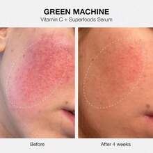 INNBEAUTY PROJECT  The Healthy Skin Edit Bestsellers Kit Graduation Birthday Holiday Summer Fall Autumn Y2K Fancy Fashion Women Brand Makeup Cosmetic Beauty Party Beach Travel Camping Outdoors School Campus Trip Festivals Decor Gift Present Rose Girl Cosplay Best Color Charm Vibe