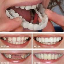 4pcs Smile Teeth Whitening Decoration Set, 2nd Generation, Easy To Use