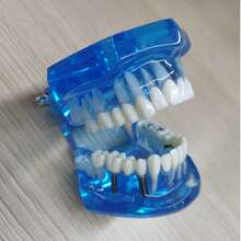 WWKTS Removable Dental Model Adult Tooth Demonstration Anatomical Medical Practice Model - Blue - View 2