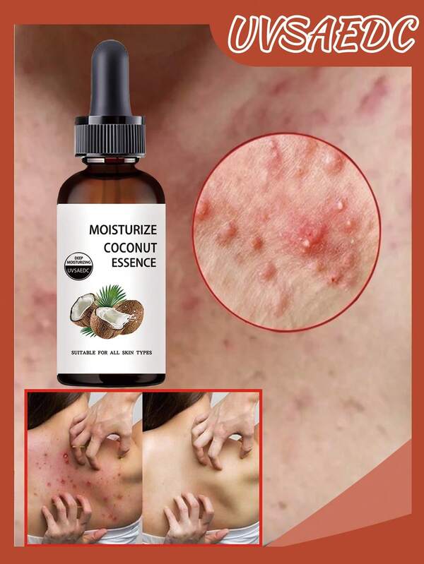 All-Round Hydrating Coconut Essence, Suitable For All Skin Types