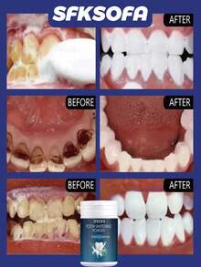 深层美白+清新感受！牙齿美白粉，重拾亮白自信 - 彩色 - 查看 5