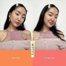 EADEM Dew Dream Hydrating Cleansing Balm &Amp; Makeup Remover With Moringa &Amp; Tiger Grass, Facial Cleanser &Amp; Skincare Moisturizer, Hydrating Skin Care Make Up Remover Balm, 34 Oz - trắng - Xem 3