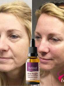 Serum Retinol 2,5% 30ml, Chống nhăn & Chống lão hóa, Dưỡng ẩm hiệu quả, Tinh chất dưỡng ẩm cho da mặt chứa Vitamin A - 30ml - Xem 2