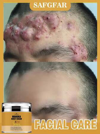 蜂蜜霜是一种舒缓保湿的面霜/保湿霜，可用于身体和面部护理，为全身提供保湿。