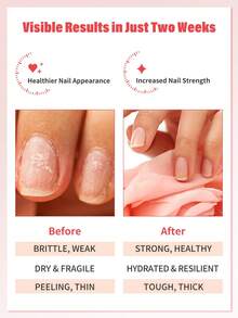 指甲强化剂 - 促进薄弱和受损指甲生长和调理 | 0.67 液体盎司，纯素且无动物实验成分，可与底油兼容 - 彩色 - 查看 3
