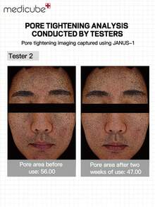 Medicube K-Beauty 70片/盒 Zero Pore Pads 2.0，双质地洁面棉片，蕴含4.5% AHA乳酸和0.45% BHA水杨酸，有效去除角质并缩小毛孔，适合所有肤质，韩国护肤品 - 70 Pcs/Box - 查看 3