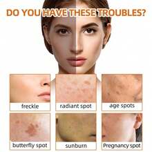 2pcs/4pcs Turmeric Soap Gentle Cleansing, Spot Fading, And Smoothing Of Fine Lines