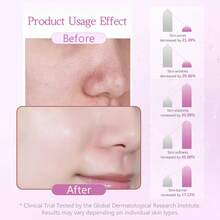 Peel-Off Face Mask, Deep Cleansing Facial Mask, Unisex Face Purifying Mask - Multicolor - View 10