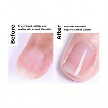 Nail Care Liquid - Nourishes The Nail Bed, Prevents Cuticle Tearing, Cuticle Oil For Nail Repair, Portable Pen Design For Convenient Use Anytime. - 無色 - 查看 7