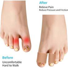 24PCS Gel Toe Protectors Covers, 0.98 Inches Toe Sleeve Tubes Pads Guards Blisters, Corn Cushions Women - 1 - Xem 7