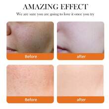 50g Turmeric Brightening Face Cream, Reduces Fine Lines, Fades Wrinkles, Brightens Complexion, Enhances Radiance, Moisturizes And Hydrates, Balances Skin Moisture, Day And Night Care - Yellow - View 5