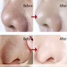 Black Head Nose Strips (Needs To Be Moistened Before Use), Natural Charcoal Blackhead Removal Cleansing Strips, Large Self-Adhesive Nose Pore Strips, Suitable For Blackhead And Pore Cleansing, Deep Cleansing, Blackhead Remover, Effective Oil Control, Unisex - Multicolor - View 6