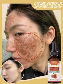 全新亮肤之选：血橙维生素C面部精华液，具有保湿紧致功效，适合所有肤质，为肌肤提供多重护理。 - 彩色 - 查看 1