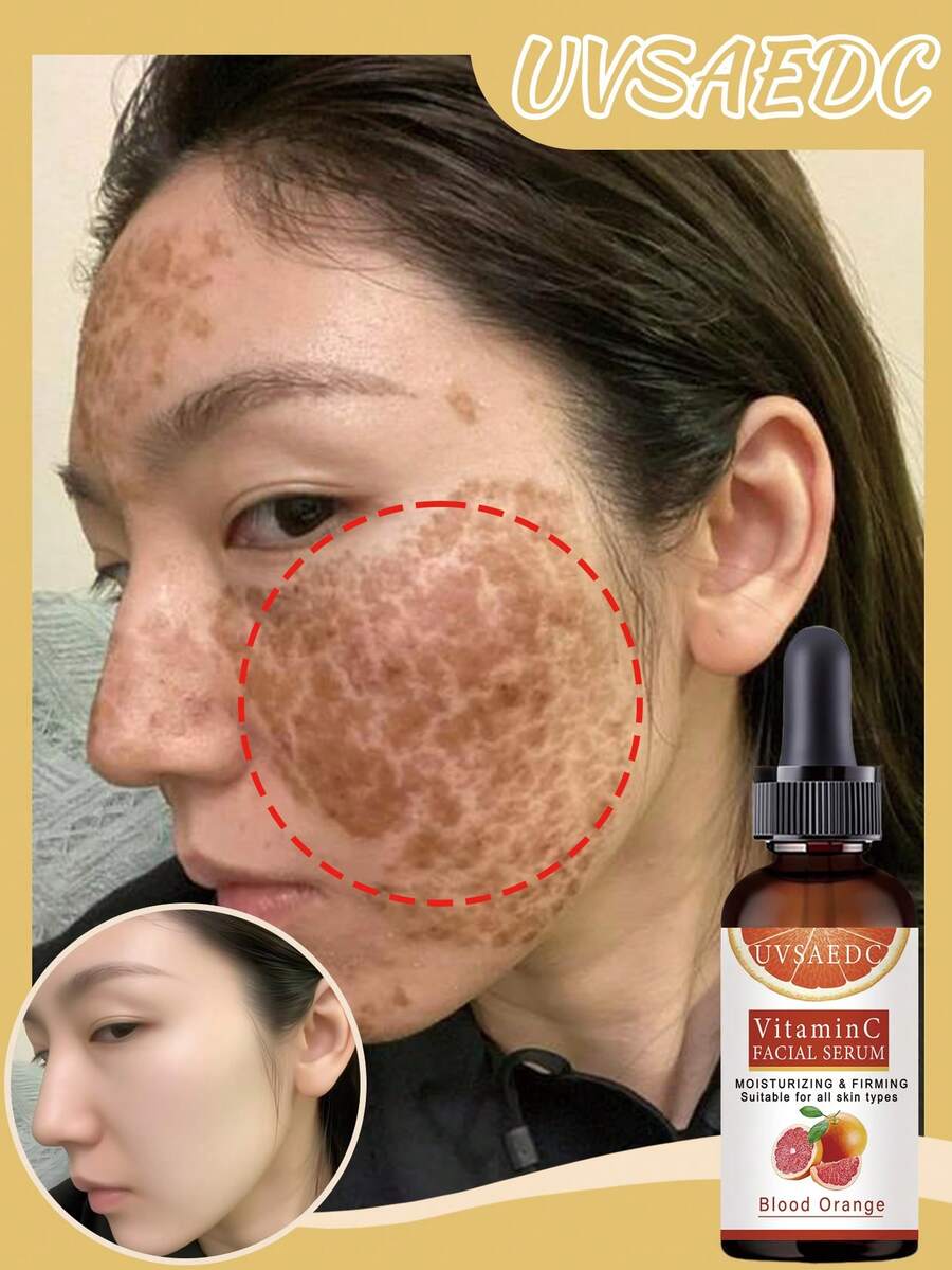 全新亮肤之选:血橙维生素C面部精华液,具有保湿紧致功效,适合所有肤质,为肌肤提供多重护理。 - 彩色 - 查看 1