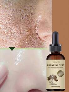 乳香精油，“舒缓面部肌肤”镇静滋养 - 彩色 - 查看 3