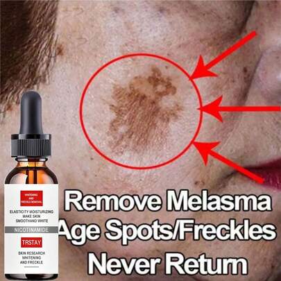 Crema blanqueadora efectiva TRSTAY, para aclarar manchas faciales, eliminar manchas oscuras, melasma y pigmentación, mejorar la opacidad, crema para el cuidado de la piel