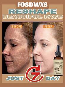 乳香精油，“舒缓面部肌肤”镇静滋养 - 彩色 - 查看 6