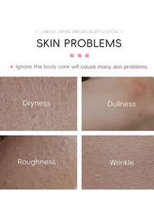 1pc 200g Sakura Body Lotion, Moisturizing, Long-Lasting Fragrance, Hydrating, Suitable For Daily Skin Care, Holiday Gifts, Valentine's Day Gifts. Deep Moisturizing Body Lotion Prevents Dryness And Cracking, Improves Uneven Skin Tone, Long-Lasting Hydration, Smooth And Radiant Skin, Enriched With Nutrients, Vitamins And Natural Extracts, Enhances Skin Elasticity, Promotes All-Day Healthy Glow