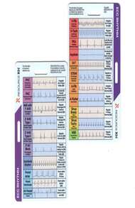 EKG Rhythm Interpretation Badge Card – Quick Reference Guide For ECG ...
