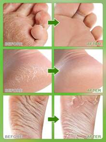 Foot Peeling Mask (6 Pack) Exfoliant For Peeling Off Calluses, Natural Exfoliator For Dry Dead Skin, Callus, Repair Rough Heels Soft Smooth Touch