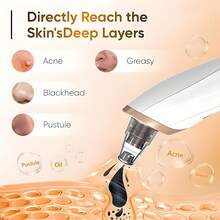 Blackhead Pore Removal Vacuum, Facial Pore Cleanser - 5 Suctions, 5 Probes, USB Rechargeable Blackhead Vacuum Kit, Acne Removal Tool For Adults. Suitable For Bathrooms. Bedchamber. Holiday Gifts For Female Friends And Female Classmates In Places Such As Travel - 皮膚清潔儀 - 查看 4